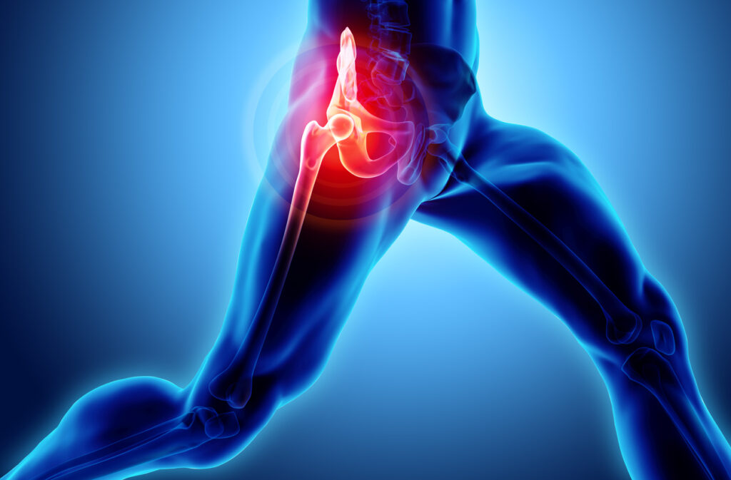 Hip Pain: Causes and Treatment